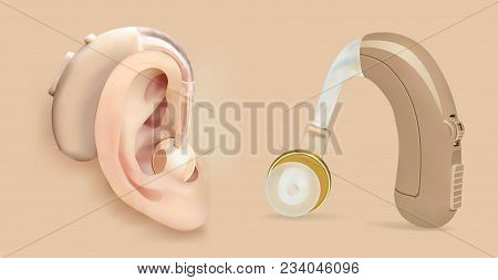 Vector Hearing Aid Behind The Ear. Sound Amplifier For Patients With Hearing Loss. Treatment And Pro