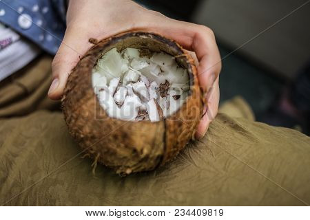 Coconut. The Girl Is Holding A Coconut In Her Hand. Pieces Of Coconut Pulp.