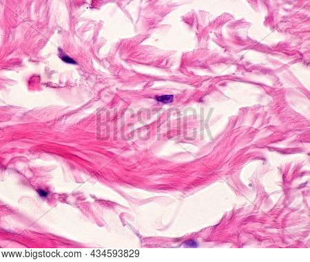 Collagen Fibers Arranged Forming Large Bundles In The Dense Irregular Connective Tissue Of Reticular