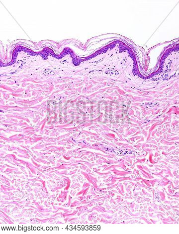 Low Magnification Micrograph Of A Human Thin Skin Showing The Epidermis And A Very Thick Dermis, Cha