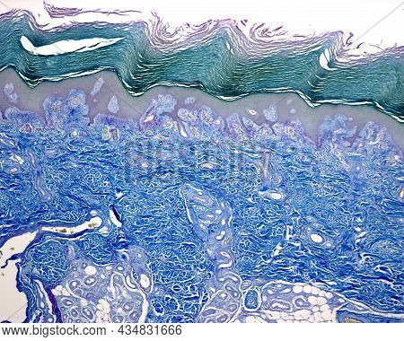 Low Power Micrograph Of The Thick Skin, Stained With The Cajal-gallego's  Method. With This Method C