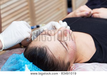 Injections On The Face With Cosmetic Procedures.