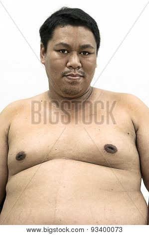 Fat Naked Upper 图片和照片（免费试用） | Bigstock