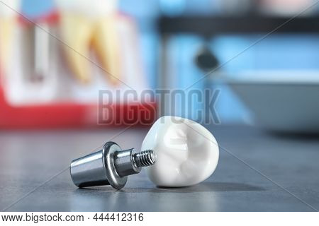 Abutment And Crown Of Dental Implant On Table In Clinic, Closeup