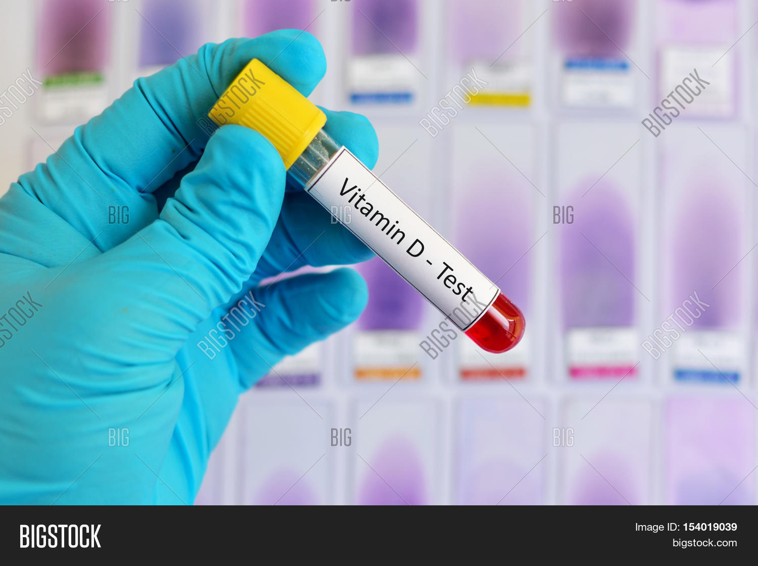Test Tube Blood Sample Image & Photo (Free Trial) Bigstock