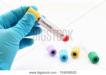 Blood sample positive with Chlamydia trachomatis bacteria