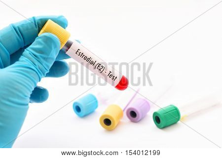 Test tube with blood sample for estradiol hormone test