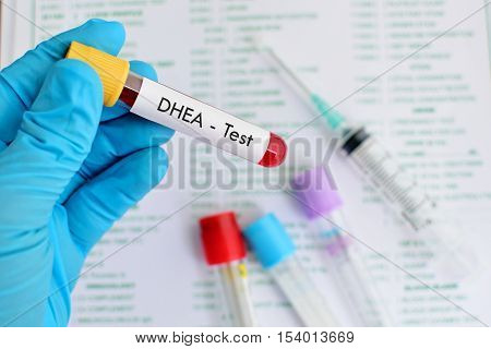 Blood sample for DHEA (dehydroepiandrosterone) hormone test
