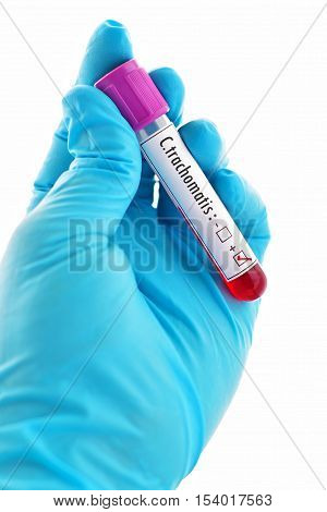 Blood sample positive with Chlamydia trachomatis bacteria