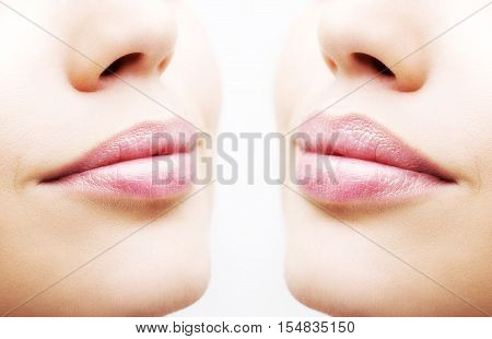 Before and after lip filler injections. Close up over white background