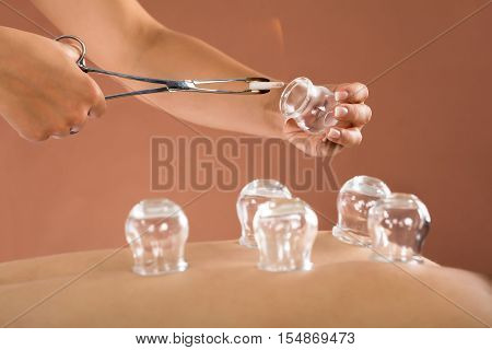 Close-up Of A Therapist Giving Cupping Therapy To Man In Spa