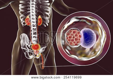 Chlamydiosis Infection In Man, 3d Illustration Showing Close-up View Of Chlamydia Trachomatis Bacter