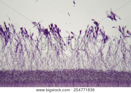 Microscope Photo A Bundle Of Penicillium Fungi