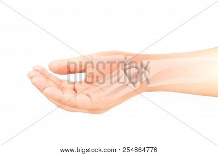 Wrist Bones Injury White Background Wrist Pain