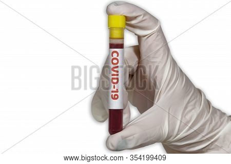 Coronavirus World Outbreak Concept With Covid-19 Tag On Vacutainer. Female Chemist With Protective G