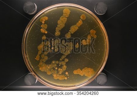 Petri Dish With A Colony Of Bacteria On A Dirty Hand