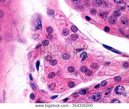 High Magnification Micrograph Of A Group Of Interstitial Leydig Cells, In The Testis. They Are Polyh