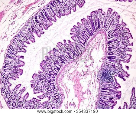 Mucosa Layer Of The Large Intestine With Lieberkühn Crypts, Lined With Numerous Goblet Cells Of Pale