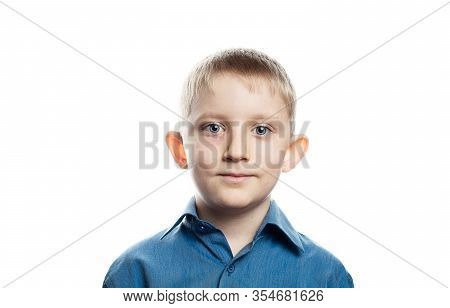 Herpes Is An Eye Disease On The Face Of A Child. Little Boy With Conjunctivitis. Rash Near The Eye. 