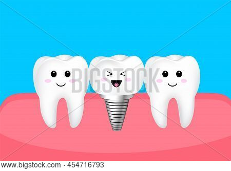 Cartoon Tooth Character With Dental Implant. Dental Care Concept. Tooth Implant Screw In Gum, Vector