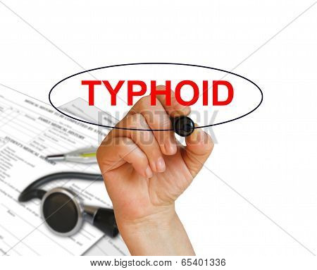 Typhoid