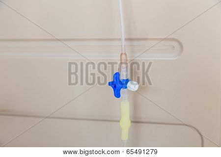 Junction Control For Infusion Set