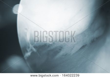 Arthroscopy Surgery Screen