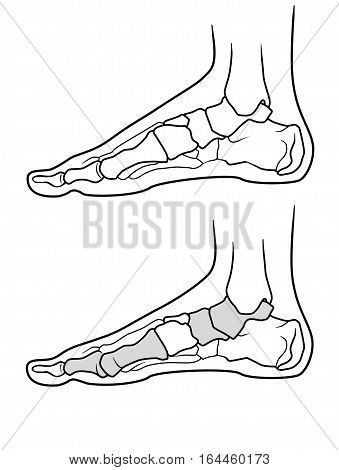 The structure of the legs with flat feet and normally feet on a white background