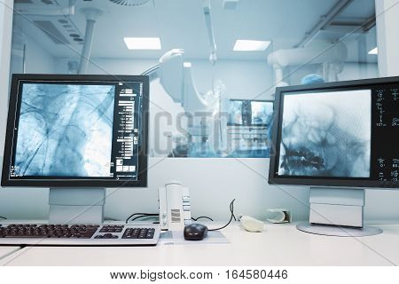 Computer monitoring of brain operation. Modern equipment background
