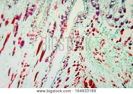 Cell Pinus Female Strobile Ls