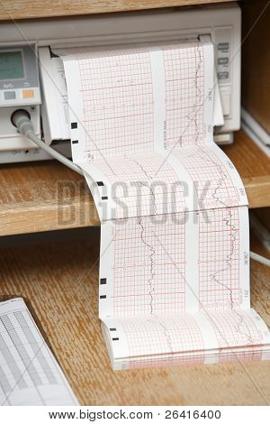 Bir ekg bir hostital yazdırabilirsiniz