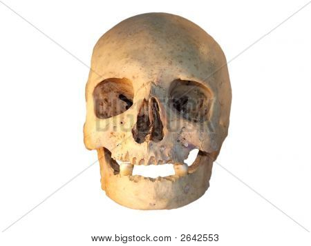 Homo