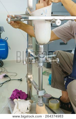 Medical Technician Make A New Aluminium Prosthesis Legs For Amputee Patient