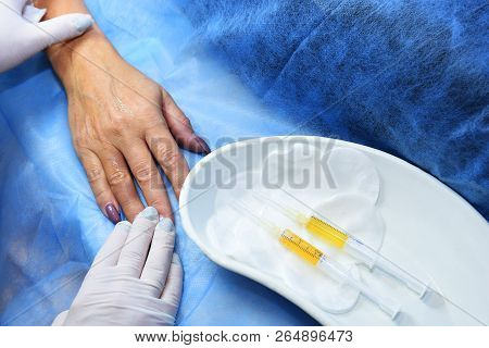 Plasmolifting Hands. Injections For Rejuvenation And Skin Regurgitation From Human Plasma. A Modern 