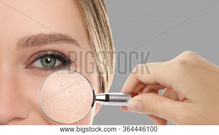 Young Woman With Dry Skin Visiting Dermatologist, Closeup