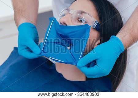 Dentistry Cofferdam Installation Procedure. Modern Dental Treatment