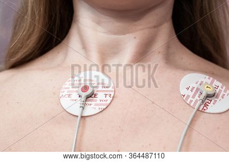Kogalym, Russia-04.27.2020:ecg Electrodes On A Woman Chest, Diagnosis Of A Patient Heart Rhythm