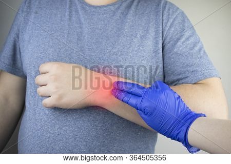 A Man’s Wrist Hurts. Traumatologist Examines A Hand. Wrist Pain As A Sign Of Tunnel Syndrome Or Spra