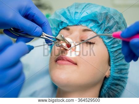 Laser Vaporization Of Nasal Concha With Coblation Technology Method