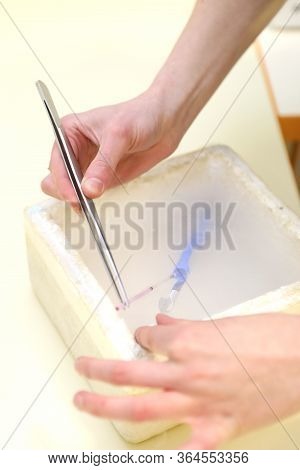 Clinic Of Reproductive Medicine. Artificial Insemination. Clinic Of Artificial Conception. Sperm Fre