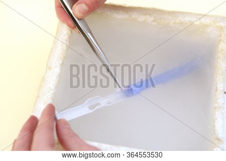 Clinic Of Reproductive Medicine. Artificial Insemination. Clinic Of Artificial Conception. Sperm Fre