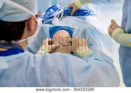 Arthroscope Surgery. Orthopedic Surgeons In Teamwork In The Operating Room
