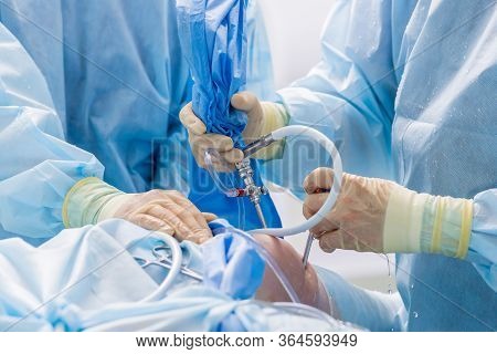 Arthroscope Surgery. Orthopedic Surgeons In Teamwork In The Operating Room