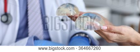 Close-up Of Female Hands Holding Silicone Implants In Hands. Plastic Surgeon In Medical Gown Advisin