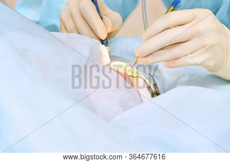 People At Hospital Background. Blue Medical Backdrop. Healthcare Support. Cardiology Sick Patient. O