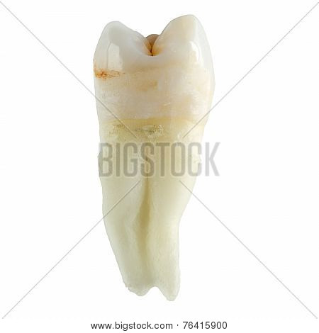 Extracted Wisdom Tooth On White Background