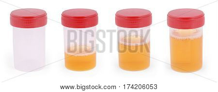 Sterile Medical container for urine with biomaterial isolated on white