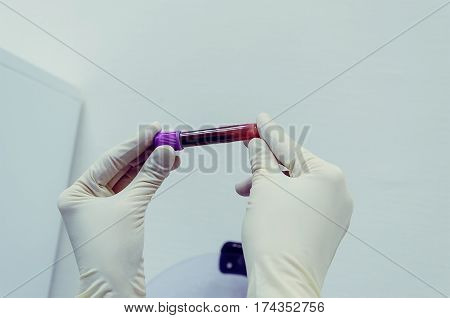 biochemical lab picked up a tube of blood tests to check. dopping, cholesterol, HIV