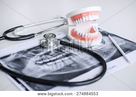 Dental Model And Equipment On Tooth X-ray Film And Stethoscope Used In The Treatment Of Dental And D