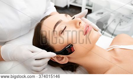 Beautician Doing Skin Treatment Using A Microneedle Derma Roller. Woman Getting Procedure Skincare, 